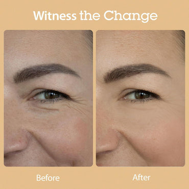 [Blithe] Vital Treatment 8 Nourishing Beans 150ml