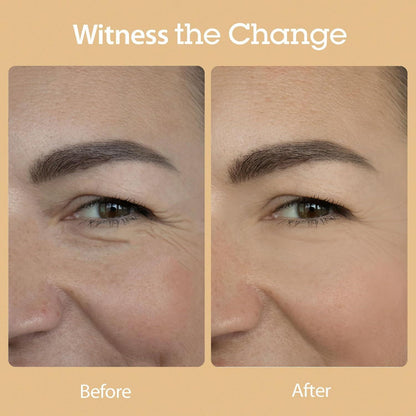 [Blithe] Vital Treatment 8 Nourishing Beans 150ml